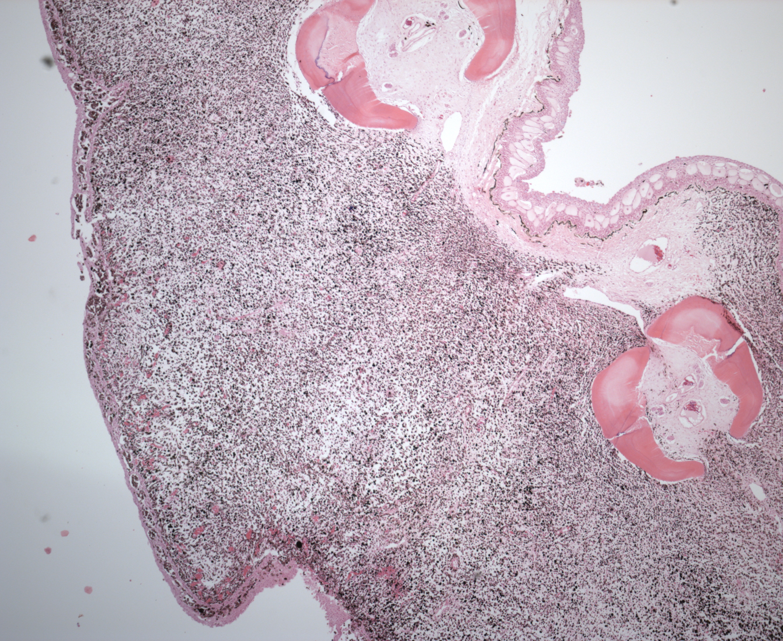 histo_slide_15-51_2_fin_4x