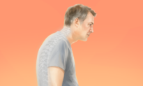 Hunchback: Spine’s Natural Curve Becomes Abnormal–Here’s How to Reverse It