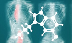 The Serotonin–Melatonin Connection to Scoliosis