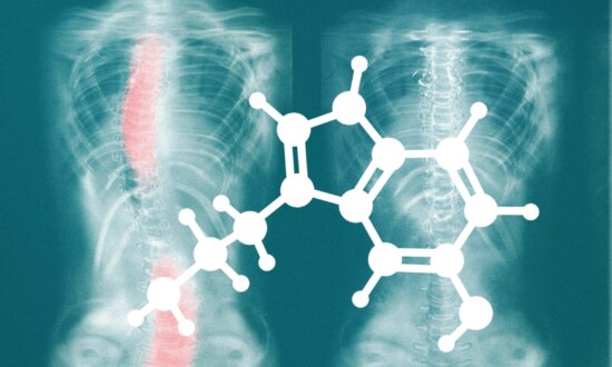 The Serotonin-Melatonin Connection to Scoliosis
