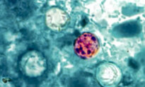 More Than 15,000 Cases of Parasite That Causes Diarrhea in US: CDC