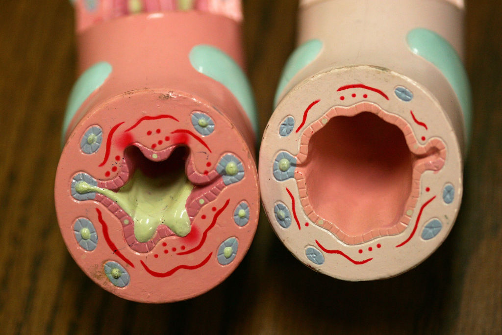 California Distributes Free Inhalers To Underserved Asthma Patients