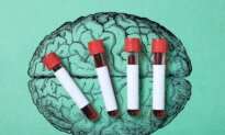 A Blood Test May Detect Alzheimer’s Years Before Symptoms Appear—Here’s What to Know