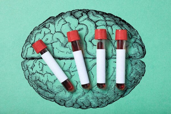 A Blood Test Can Detect Alzheimer’s–But Who Should Get One?