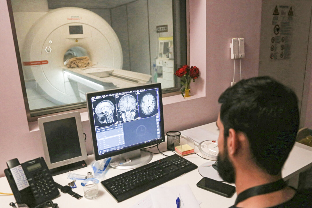 A doctor examines MRI scans, in this file photo. (Mohammed Sawaf/AFP via Getty Images)