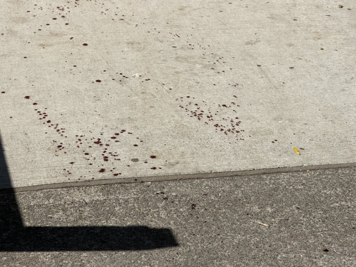 Red splatter on the ground near Redfern Park in Redfern, Sydney, on Sept. 3, 2026. A teenager on bail has found himself behind bars after he was arrested and accused of severing the hand of a boy in a popular inner city suburb. (AAP Image/Catherine Bouris)