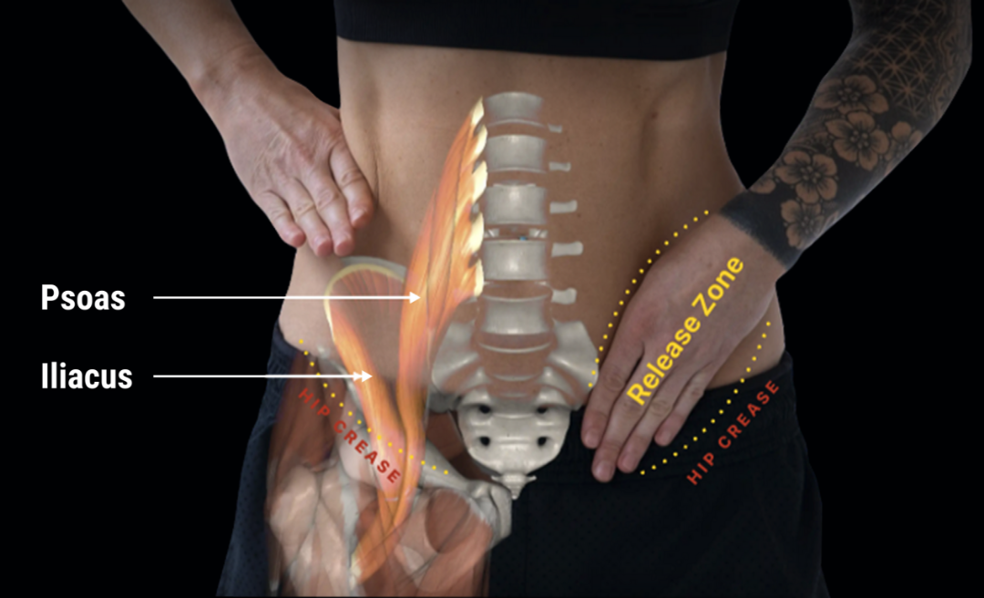 2. Iliacus + Psoas in RZ