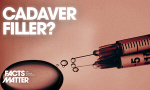 Fat From Cadavers Now Being Used for Cosmetic Fillers