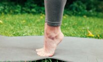 Bunions Affect 1 in 3 People–3 Exercises to Relieve the Condition