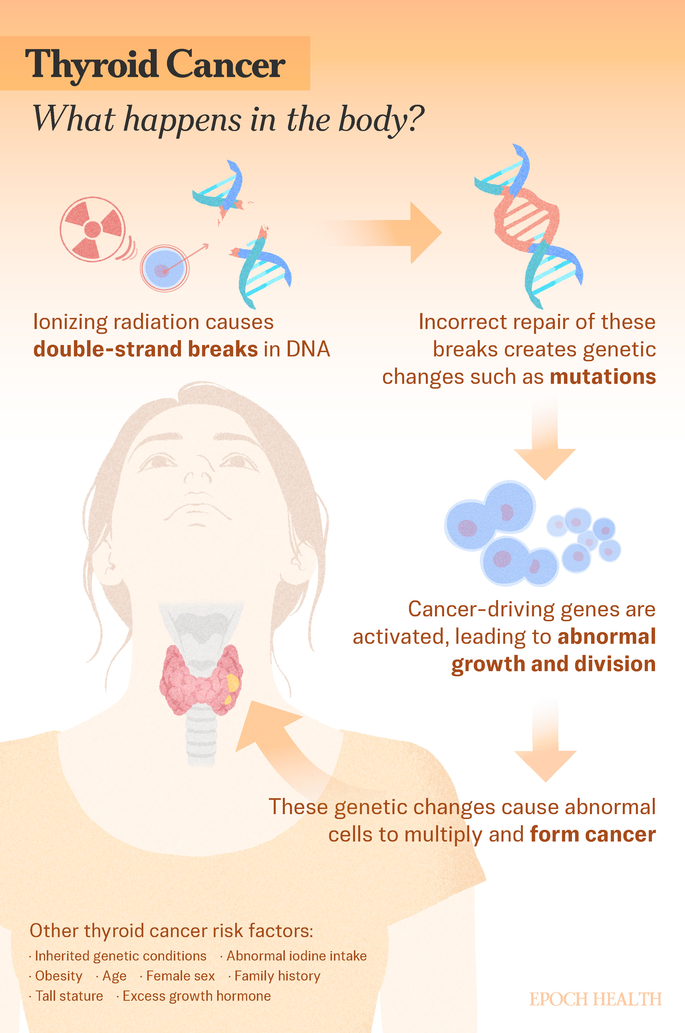 Thyroid Cancer