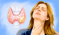 Thyroid Cancer: Silent but Treatable—11 Warning Signs to Watch For