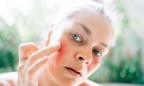 What Your Complexion May Be Telling You About Your Health