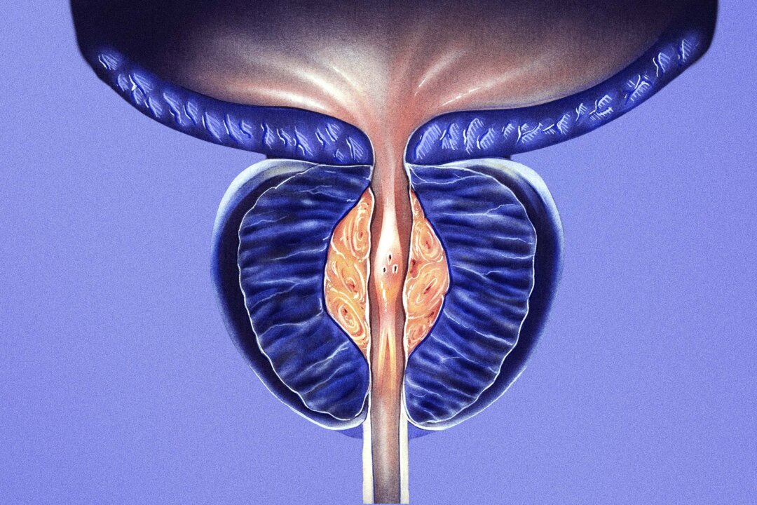 (Medical Art Inc/Shutterstock)
