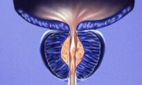 Enlarged Prostate: When to Seek Help and How to Choose Treatment
