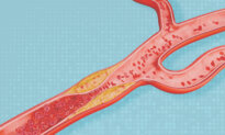 This Saturated Fat Slows Heart Disease