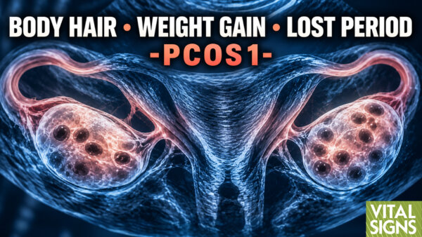 PCOS: How Eating Habits, Genes, Toxins Alter the Monthly Cycle—OB-GYN Explains | PART 1